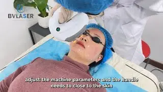 Operation of the IPL SHR machine during treatment