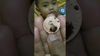 Anak kecil dikerok tidak menangis