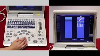 Mindray Z6: How to enter patient details and select pre-sets on the Z6 - video 1