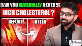 Can You Naturally Reverse High Cholesterol? Here&rsquo;s What the Science Says | Dr. Rahman Mohammed