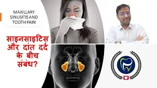 Dr Rudra Mohan |साइनसाइटिस और दांत दर्द के बीच संबंध?|LINK BETWEEN MAXILLARY SINUSITIS & TOOTH PAIN