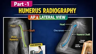 #humerus #radiography part-1 AP AND LATERAL VIEW #darkroom #anatomy 
