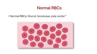 &ldquo;Blood Smear Examination: RBC Morphology & Diagnosis Explained&rdquo;