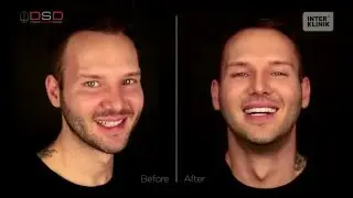 Digital Smile Design
