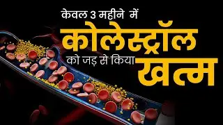 Cholesterol Control | Constipation Treatment | Liver Damage | Gas | Sugar खत्म सिर्फ 3 महीने में