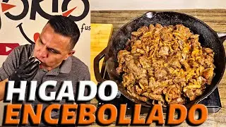 C&oacute;mo preparar f&aacute;cilmente un buen H&Iacute;GADO ENCEBOLLADO | RECETA Yokio&acute;s