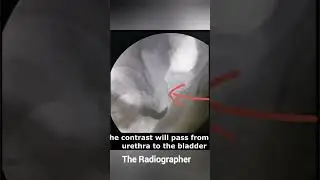 Retrograde Urethogram RUG Xray Procedure | #RUG #RetrogradeUrethrogram #xrayProcedure #xrays #cxr