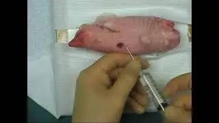 Injection of local anaesthetic tutorial