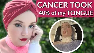 The Doctor Said I Bit My Tongue. It Was Stage 3 Cancer | Red&rsquo;s Patient Story