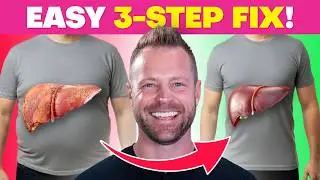 Why You&rsquo;ll NEVER Keep Fat Off Until You Fix Your Liver!