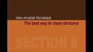 The Best Way To Clean Dentures - Brushing Up On Oral Health For Disability Residential Services