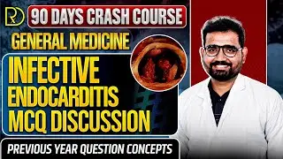 90 Days CRASH COURSE-GENERAL MEDICINE-Infective Endocarditis-MCQ discussion#neet#physiology#medicine
