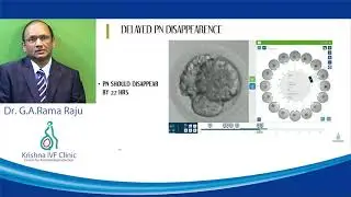 PRIMER ON TIME LAPSE EMBRYO TECHNOLOGY FOR CLINICIANS AND EMBRYOLOGIST. #DrRamaraju#krishnaivf