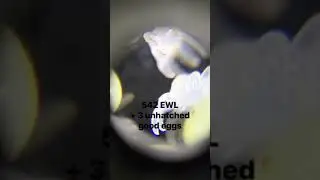 Tarantula sling eggs with legs closeup footage