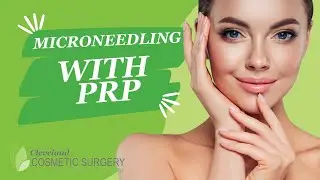 The Power of Microneedling with PRP for Skin Renewal