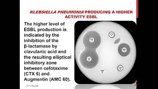 ESBL  extended spectrum beta lactamasesdynamics and detection by Dr.T.V.Rao MD