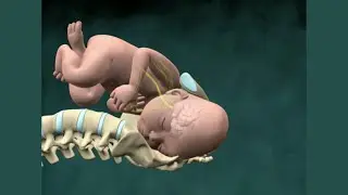 Shoulder Dystocia Birth Injury | Nucleus Health