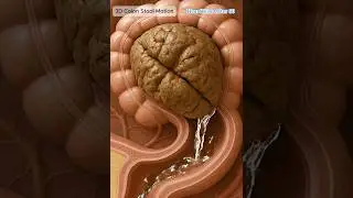 3D Colon Animation | Stool Mass Moving Under Peristalsis #anatomyshorts #shorts #motivational