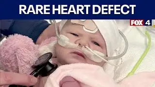 Baby with rare heart defect given life-saving surgery