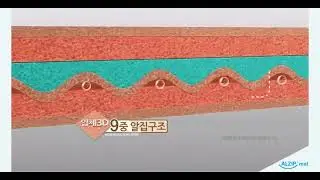Patented ALZIP structure