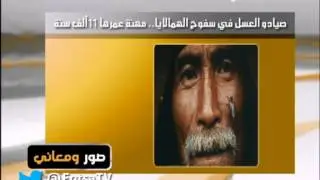 اكثر من صباح - تعرق اليدين والقدمين - العقار
