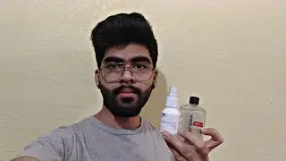 As&iacute; voy a dejar el minoxidil
