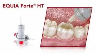 EQUIA Forte&reg; HT - Restoration Guide