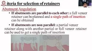 Parts of Fixed Partial Denture