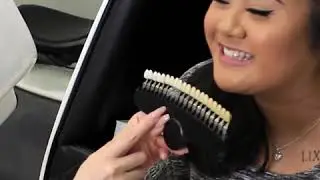 Mint Smilebar: In Office Whitening Single Session