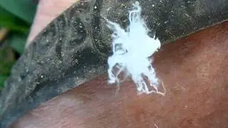 weird white bug.