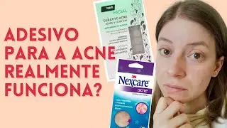 O Melhor Tipo de Adesivo para Secar Espinhas! | Adesivo Hidrocoloide - diferentes tipos, como usar