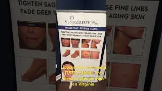 Liposucci&oacute;n Sin Cirug&iacute;a, con la m&aacute;quina (Venus freeze). #lipo #love