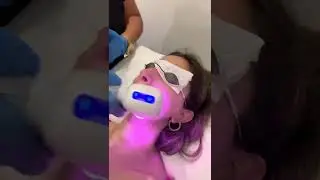 Upper Lip Laser Hair Removal at Suddenly Slimmer Med Spa Phoenix