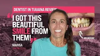 My New Smile 🦷Top Dentist in Tijuana Mexico👩&zwj;⚕️ [2024 Xdentistry Tijuana Review]