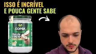&Oacute;leo de Coco Combate Queda de Cabelo e Calv&iacute;cie? Funciona Mesmo?