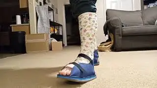 No sock Dual Short Leg Cast Walk