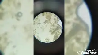 pharmacognosy senna drug powder microscopy