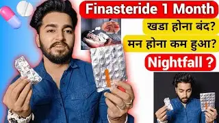 Finasteride 1 Month Experience | Sahil Nagpal