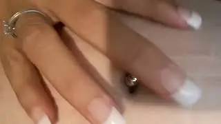 Belly Button Piercing rejection of the metal. Bellybutton piercing bad. Painfully belly button.
