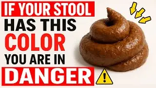 THIS Stool Color Is a RED FLAG. Don&rsquo;t Ignore It! A Serious Health Issue May Be Developing