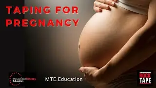 Pregnancy Taping with RockTape