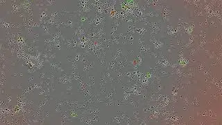 GFP cells stained with Annexin V red Incucyte