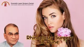 Rhinoplasty Surgery in Pune | Wide Nose Rhinoplasty & Alar Base Reduction by Dr. Krishna Chaudhari