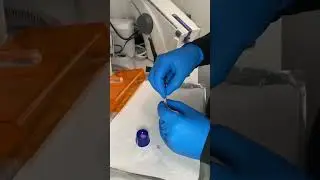 Various Steps in the Porcelain Veneer Journey
