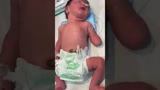 #preciousbaby #nicucare#hospital #foryou #viralvideo