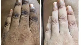 Kiboko ya sugu za mikono na miguuni Knuckles