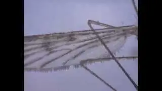 Culex pipiens - Mosquito - Microscope Music Video