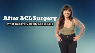 After ACL Surgery: What Recovery Really Looks Like