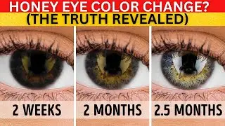 3 Ways to Improve Your Eyesight Fast at Home (आंखों की रोशनी बढ़ाने के 3 तरीके)