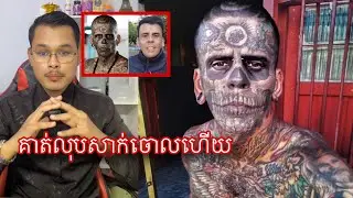 បុរសដែលសាក់ច្រើនបំផុតក្នុងលោកបានលុបសាក់ហើយ l Mr.Veasna